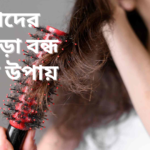 মহিলাদের চুল পড়া বন্ধ করার উপায়