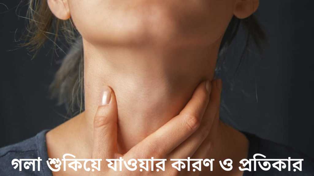 গলা শুকিয়ে যাওয়ার কারণ ও প্রতিকার