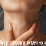 গলা শুকিয়ে যাওয়ার কারণ ও প্রতিকার